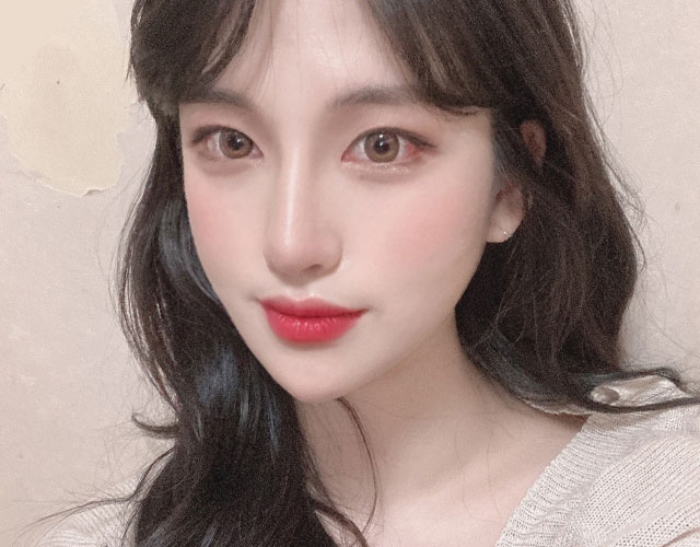 안면윤곽 after 이미지