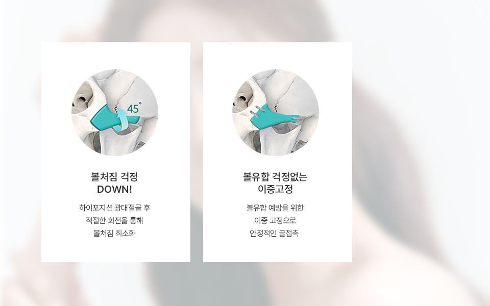 광대축소 수술 후 부작용에 대한 설명