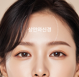 나나성형외과 이마축소술 절개 과정 설명 이미지, 상안와신경을 보존하고 모발 손상을 최소화하기 위해 사선으로 절개한 헤어라인 모습