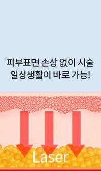 바로 일상생활 원하면