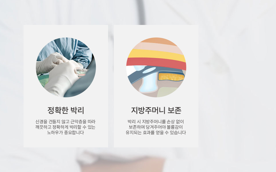 나나성형외과의 안면거상술