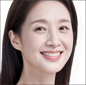 탄력 저하와 얼굴선 변화가 뚜렷해지는 시기인 40대 50대 피부 탄력 개선 리프팅을 보여주는 모델