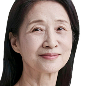 전반적인 노화 개선이 필요한 시기인 50대 60대 이상 얼굴선 목라인 리프팅을 보여주는 모델