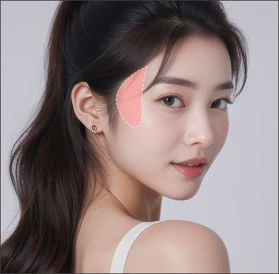 모델의 관자 부위 중심 제한적 박리 영역 표시