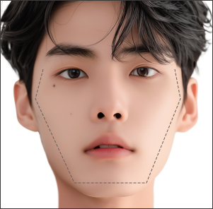 광대로 인해 옆 라인이 들어가 보이는 경우