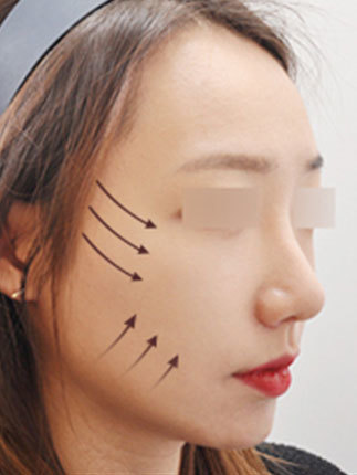 큐엔에이 이미지