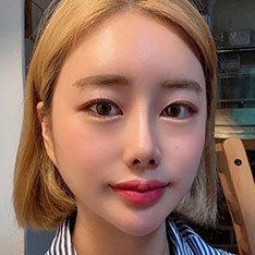 남자성형 Before & After