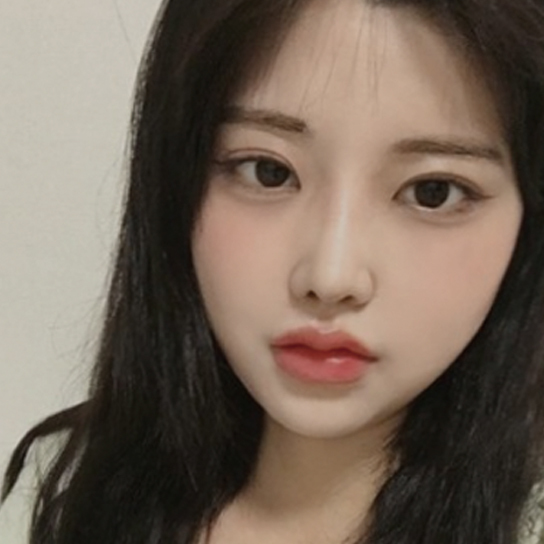 안면윤곽 눈매교정 수술 전후사진으로 얼굴 변화를 확인하는 리얼 셀피 후기