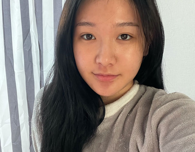 코 before이미지