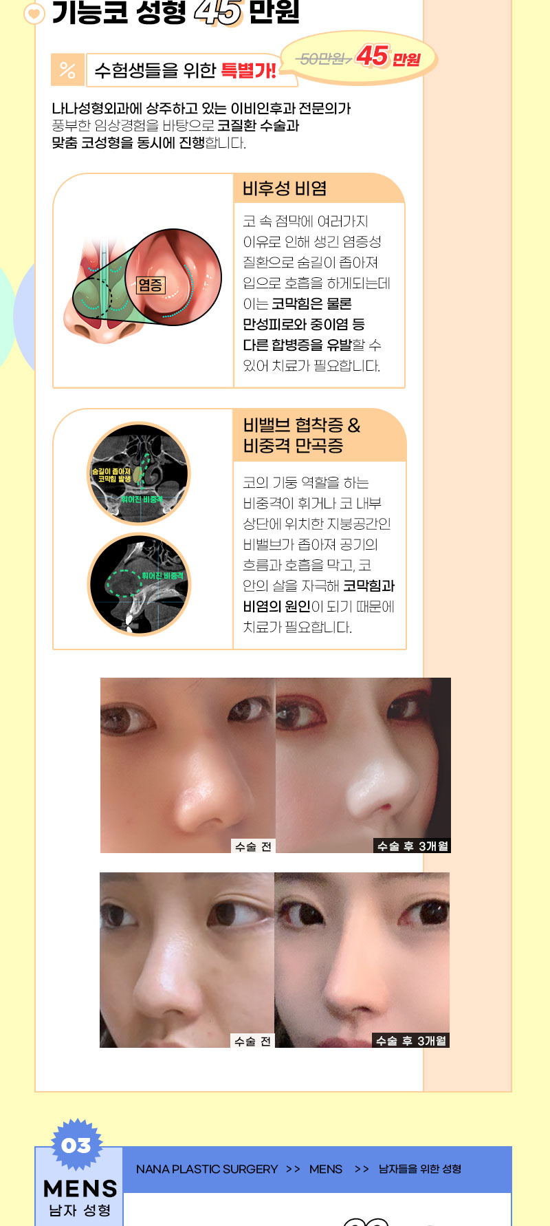 랜딩이미지