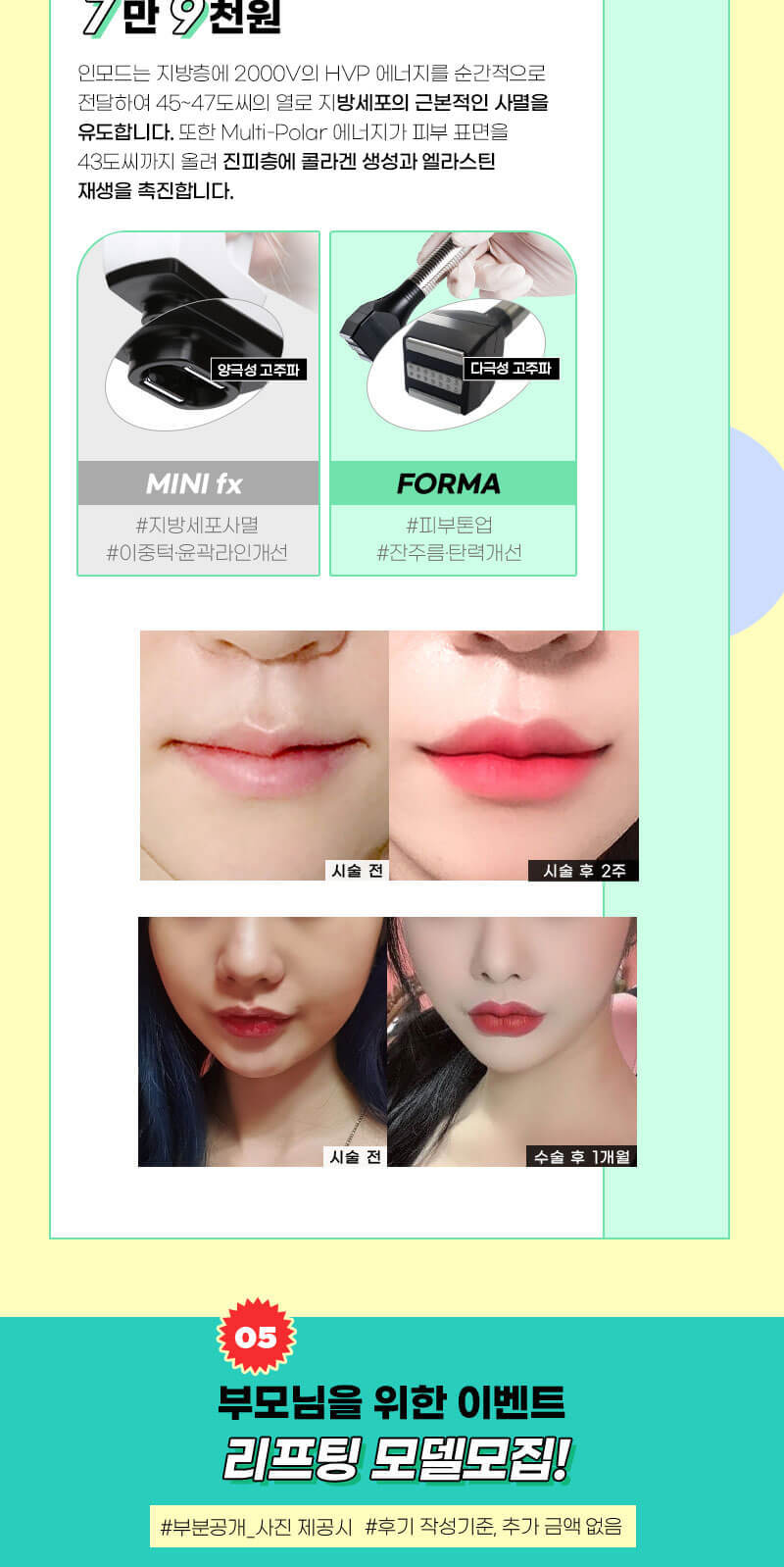 랜딩이미지