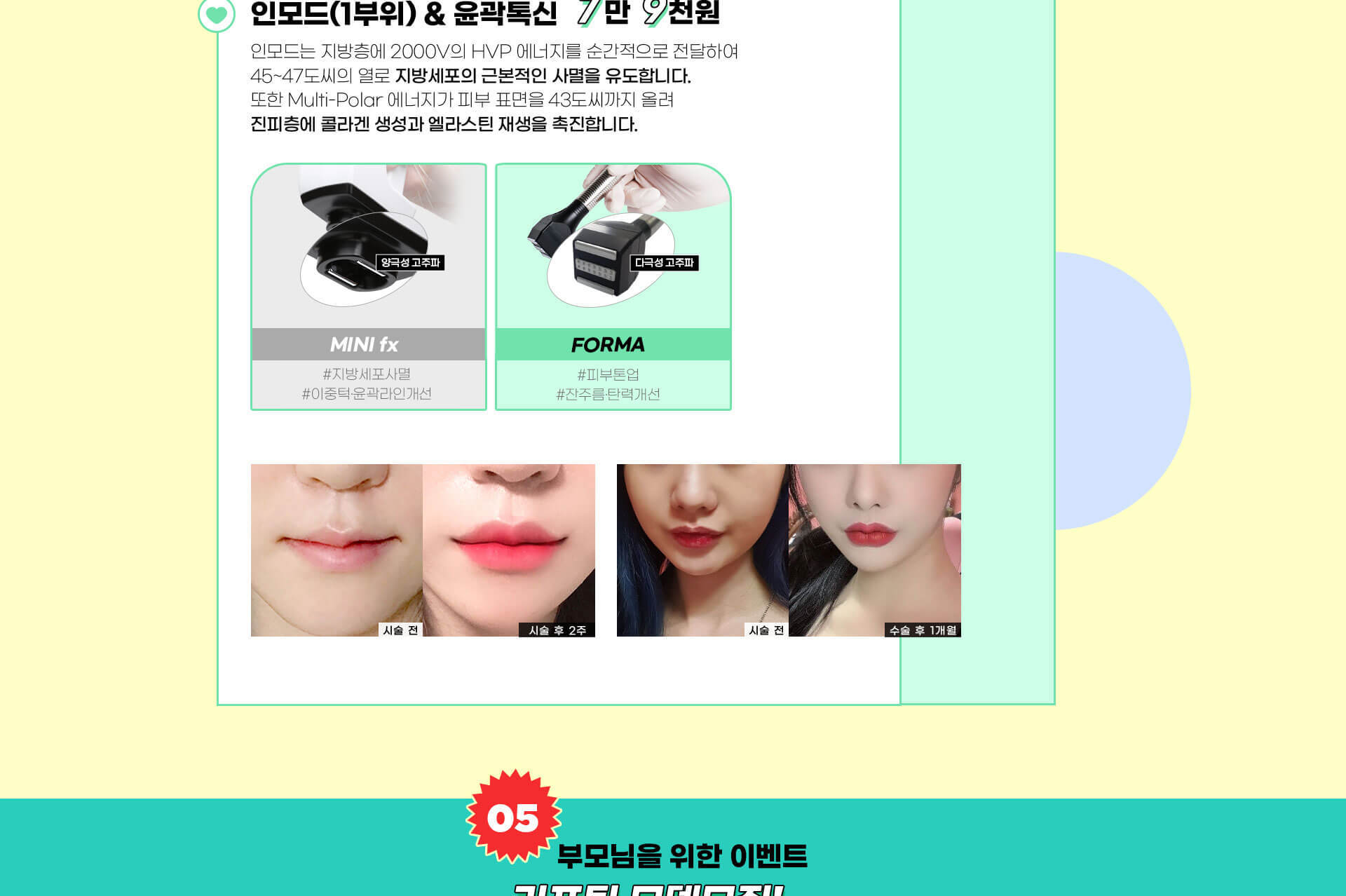 랜딩이미지
