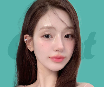 자연유착 눈매교정