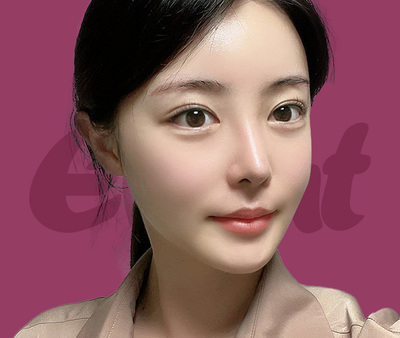 풀 HD내시경 이마거상술