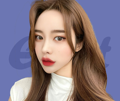 나나 눈 재수술