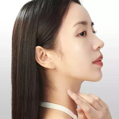나려한 포인트 코성형