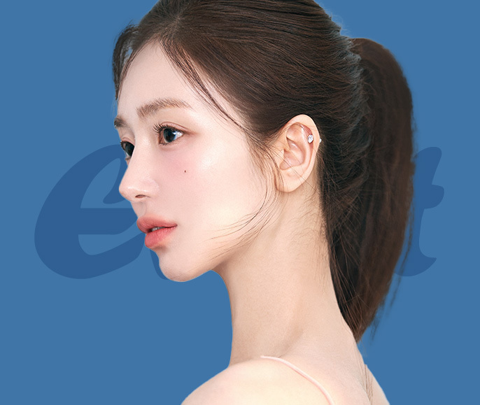 나려한 포인트 코성형