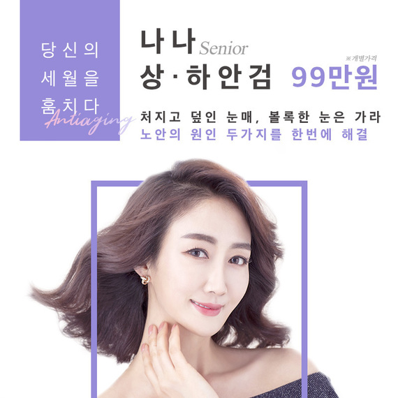상하안검_instagram